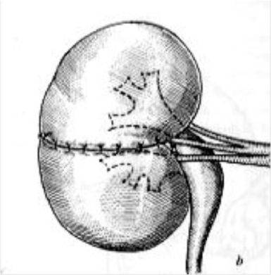 cancer-rein-3